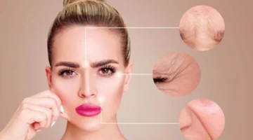 4 وصفات طبيعية لتقليل تجاعيد الجبهة وعلامات الشيخوخة بالبشرة